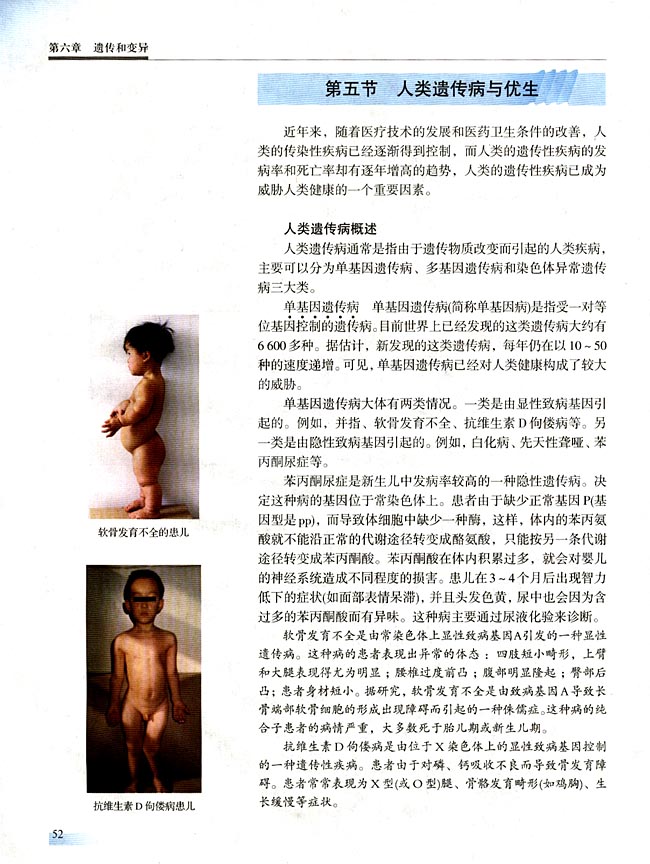 第五节 人类遗传病与优生(第52页)